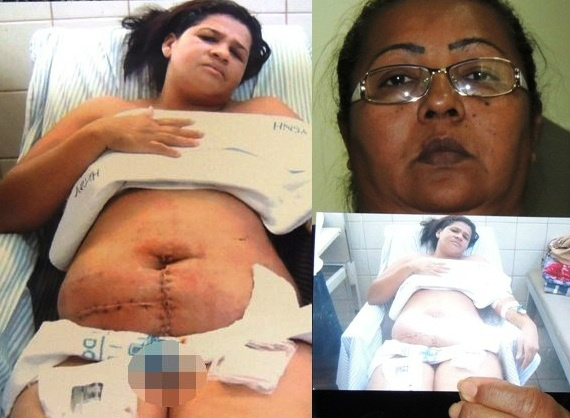 A esq. Carmiranda acamada, após o processo cirúrgico a que foi submetida. A tia Cecília Aparecida mostra a foto da sobrinha e clama por ajuda.Foto: Rádio Caçula