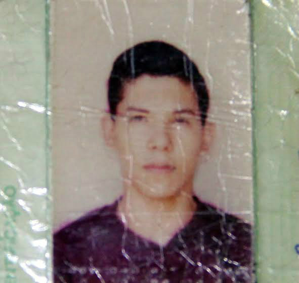 A bala entrou no lado esquerdo cabeça da vítima e ficou alojada- Fotos: Divulgação