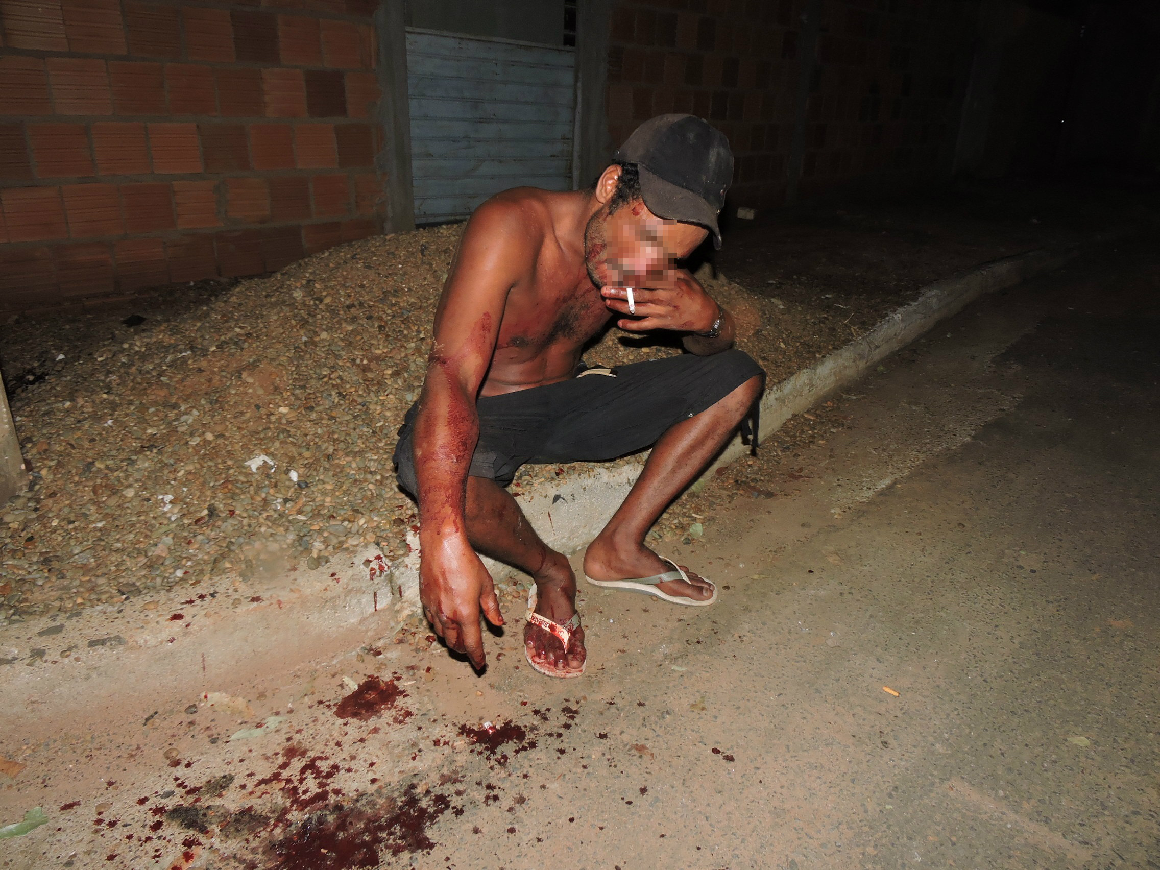 Um homem de 35 anos levou uma facada na mão direita, na noite de ontem (1º) e teve como consequência três cortes em três dedos e um tendão atingido Foto; Rádio Caçula