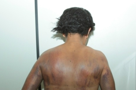 Ela tinha muitas marcas pelo corpo.Foto: Reprodução