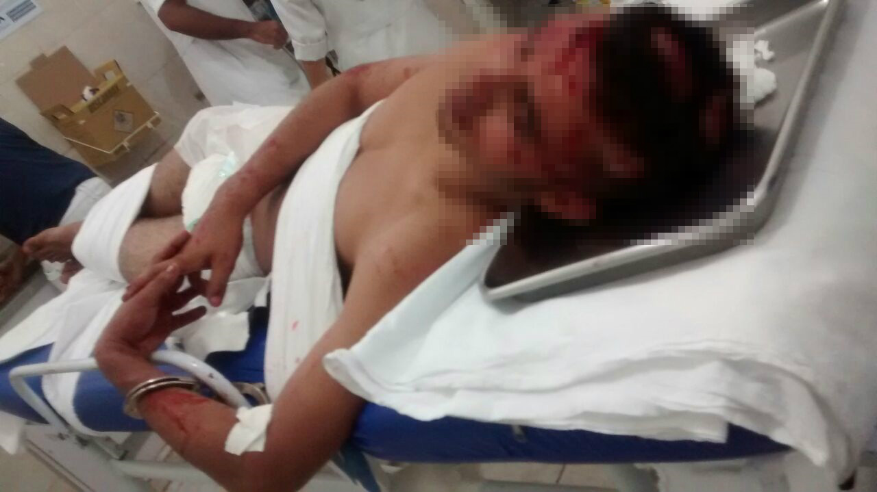 Por volta das 7h dois assaltantes invadiram uma casa na Rua José Hamilcar Congro Bastos, no bairro Jd. Dourados. Foto: Rádio Caçula