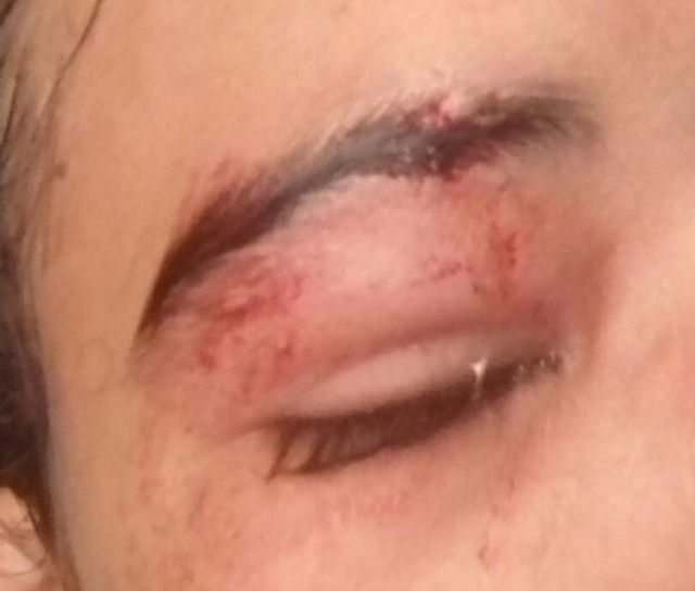 Um dos motivos para não retornar para a casa dos pais, seria uma agressão do irmão sofrida por Larissa - Foto: Arquivo pessoal
