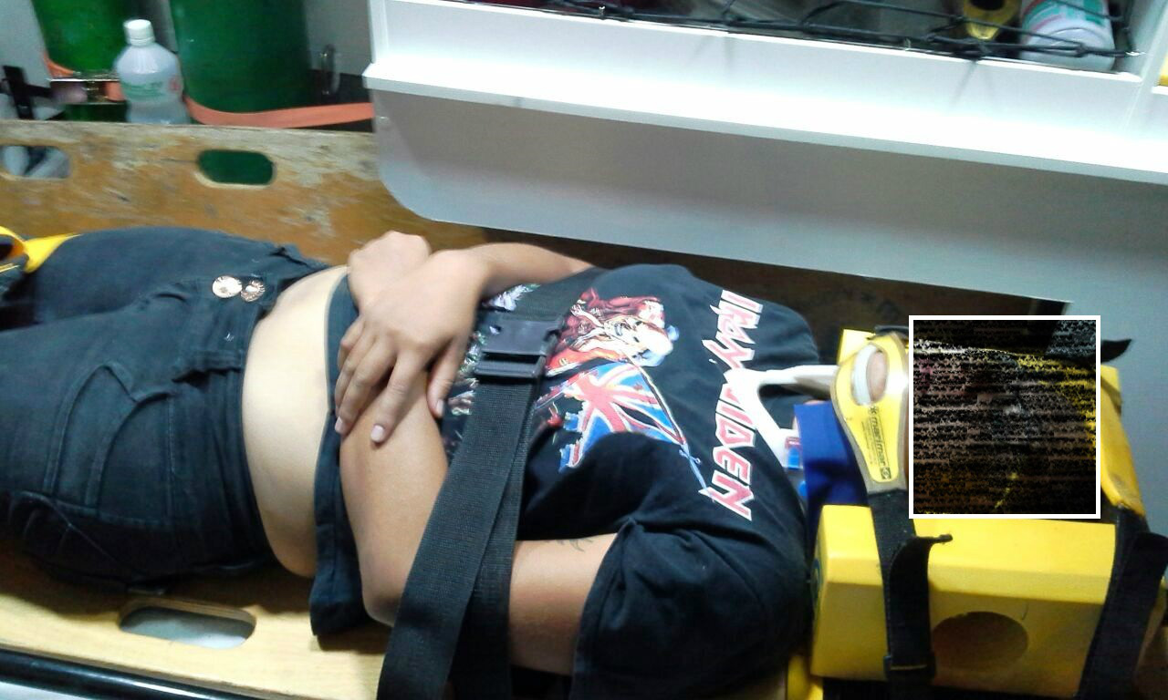 A vítima foi socorrida pelo Corpo de Bombeiros com dores no joelho e foi encaminhada para a UPA. Foto: Rádio Caçula.