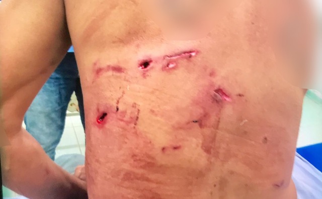 De acordo com os bombeiros, o homem foi levado para o hospital da cidade. Ele foi atendido e liberado no mesmo dia - Foto: Divulgação/Corpo de Bombeiro