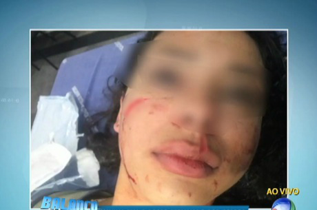Jovem teve o rosto retalhado após curtir comentário na internetReprodução Rede Record