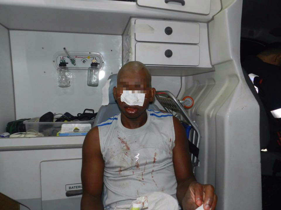 Haitiano agredido. Foto: Rádio Caçula