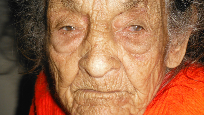 Dona Natalina machuca os olhos de tanto coçar.