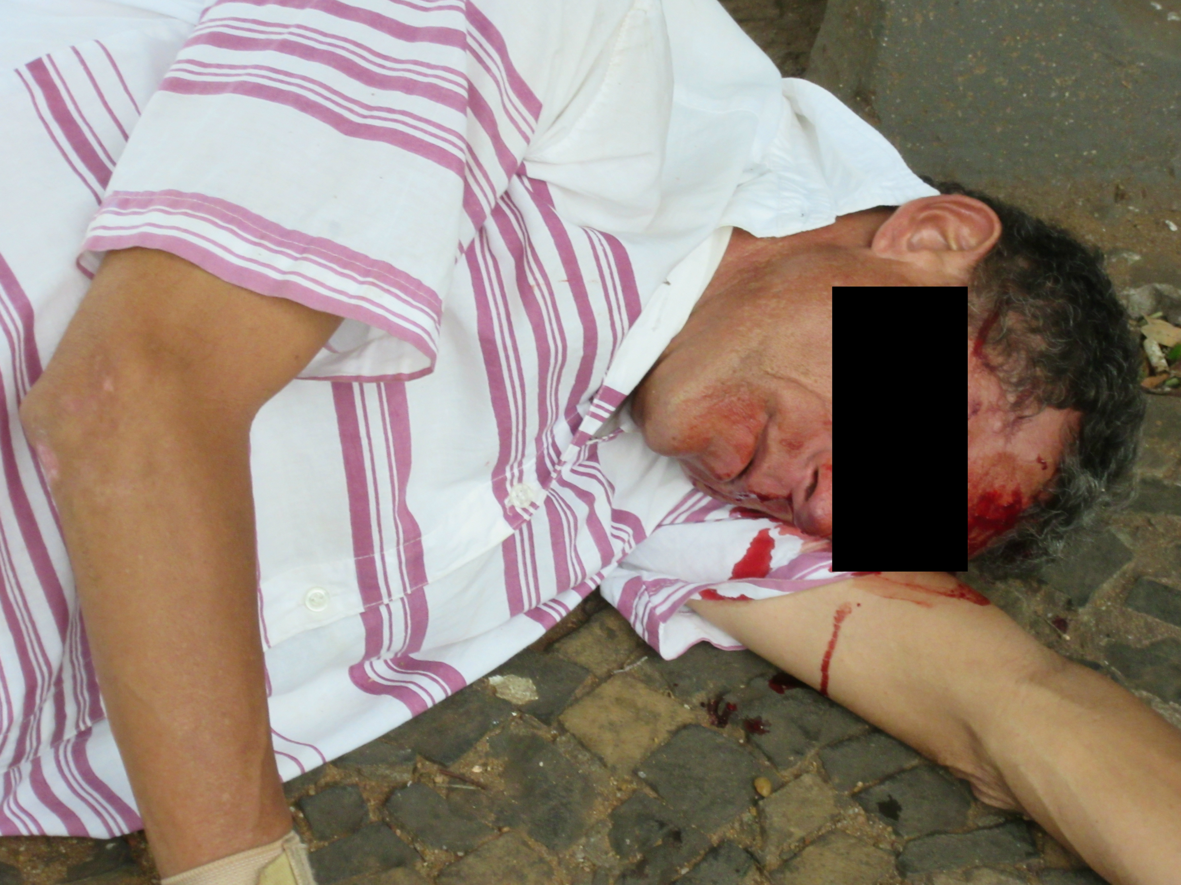 Este homem caiu de bicicleta e acabou se ferindo. Foto: Rádio Caçula