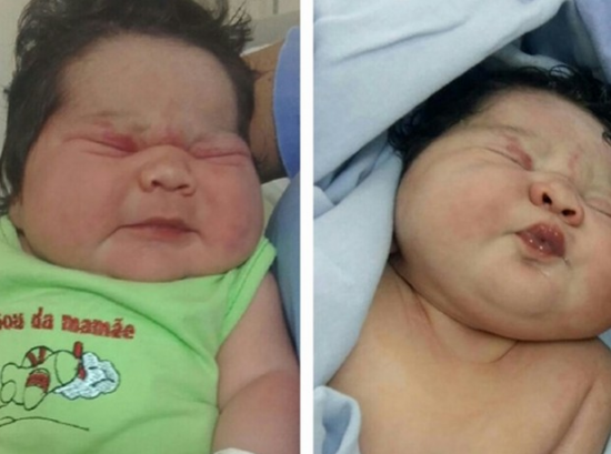 Bebê nasce com mais de cinco quilos na Santa Casa de Rio Preto