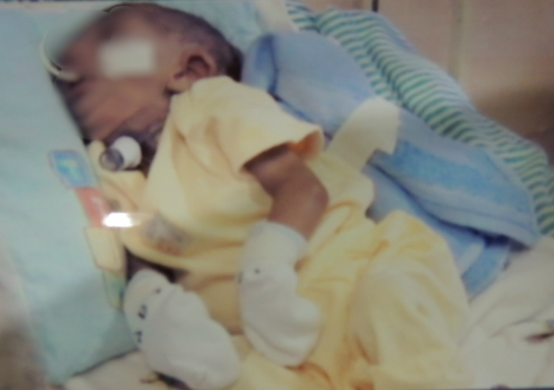 O bebê lua para sobreviver em meio a tantos problemas de saúde.Foto: Arquivo Pessoal