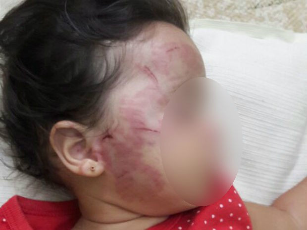 Família diz que bebê de 11 meses foi mordido e sofreu maus-tratos em creche em Rondonópolis (Foto: Arquivo pessoal)