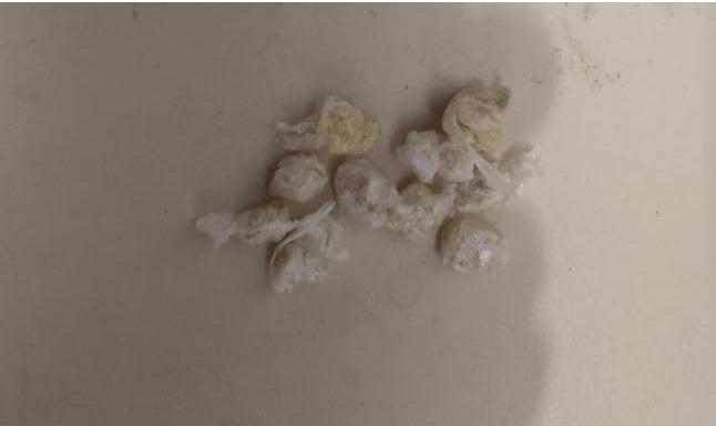 Na abordagem foram aprendidas 10  porções de crack. Foto: 2º BPM