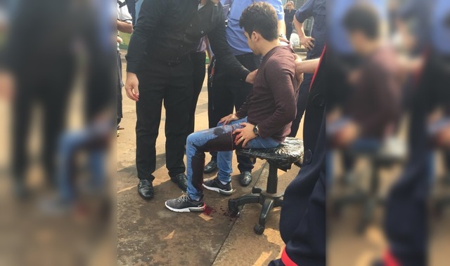 Imagens que estão circulando pelas redes sociais mostram jovem com marca de sangue na perna esquerda – Foto: Reprodução