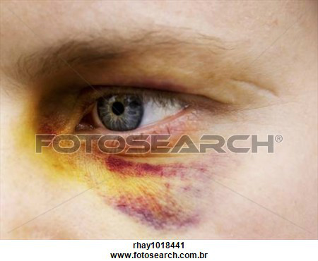 imagem ilustrativa - google