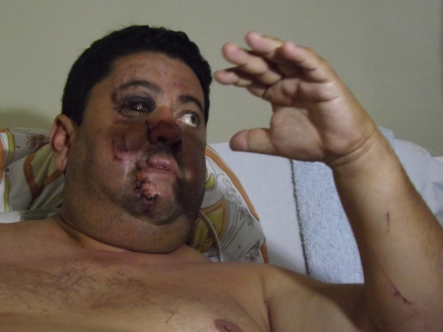 Marcos Lavezo