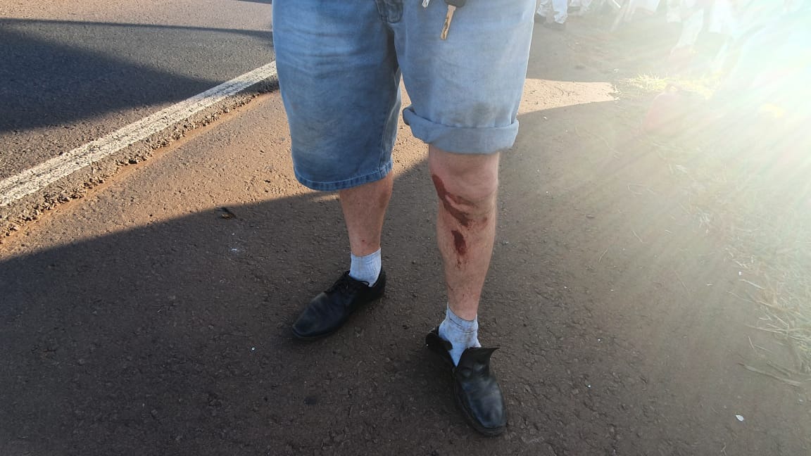 Com o tombamento, o motorista sofreu apenas escoriações na perna esquerda, safando-se do acidente consciente e orientado.Foto: Fábio Campos/Rádio Caçula.