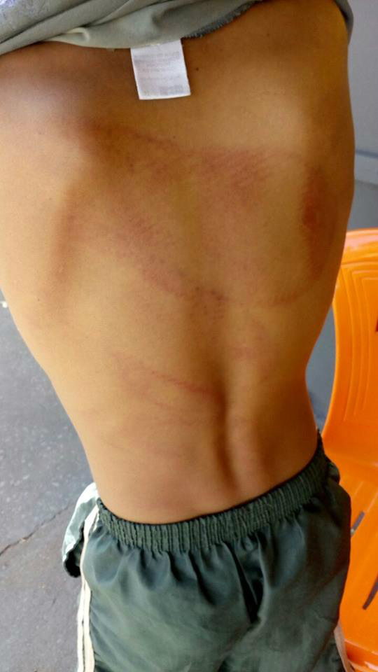 O garoto foi espancado pelo pai e a mãe registrou boletim de ocorrência. Foto: Reprodução Facebook