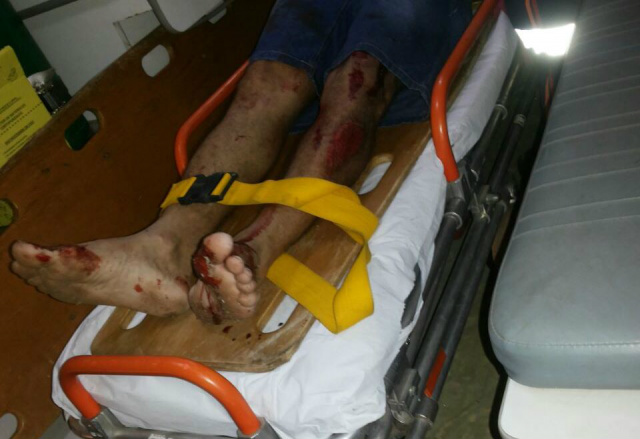 Vítima teve escoriações por todo o corpo. (Fotos: Rádio Caçula).