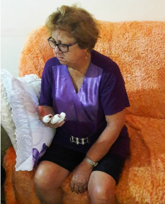 Luíza Rodrigues de Oliveira moradora no bairro Nossa Senhora Aparecidacolocou os dedos nas frestas com a intenção de abrir a porta.Foto Rádio Caçula