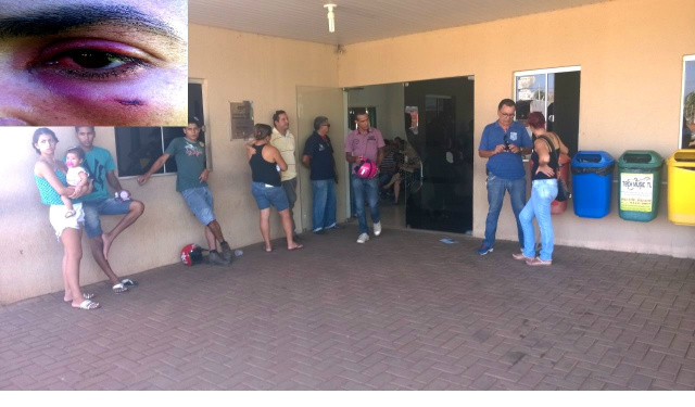 Por conta do grande número de pacientes, moradores são obrigado a esperaram do lado de fora. (Foto: Rádio Caçula).
