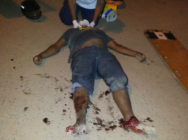 Motociclista teve vários ferimentos pelo corpo e foi socorrido pelo Samu. (Fotos: Rádio Caçula).