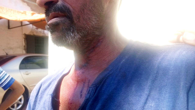 (Foto: Lucas Gustavo/ Rádio Caçula).