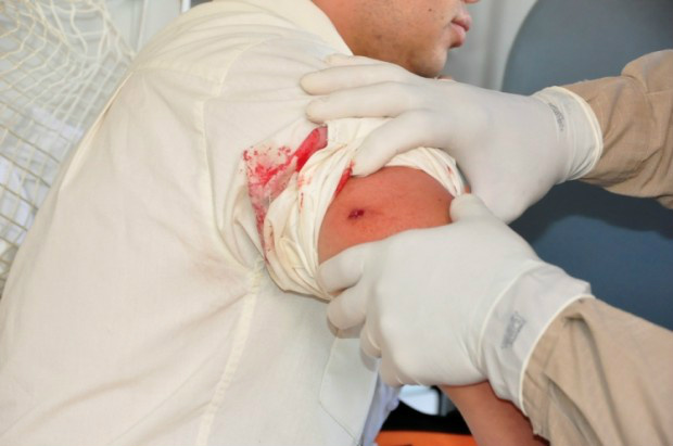 Na intenção de intimidar funcionários da unidade, adolescente dispara contra atendente (Foto: Nova News )