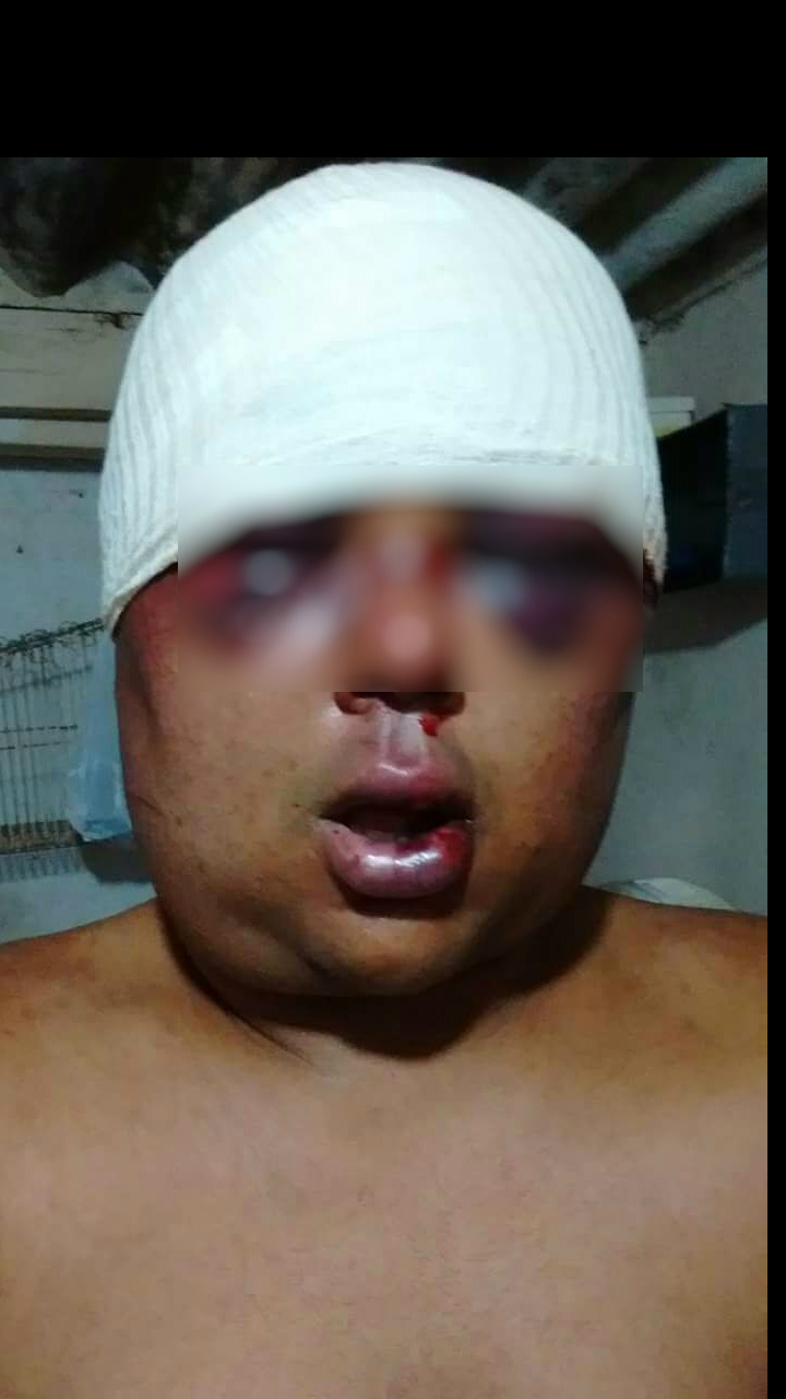 O cabeleireiro C.L, foi brutalmente espancado por duas pessoas. Foto: Reprodução Facebook. 