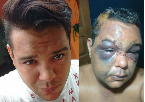 Caio Lopes foi brutalmente espancado por duas pessoas em Três Lagoas. 